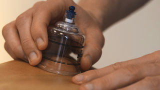 Hidžama (Cupping) – tradicionalne i medicinske dimenzije