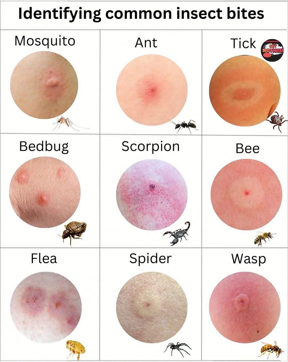 The appearance of a sting or bite can vary greatly depending on the individual’s allergic reaction.