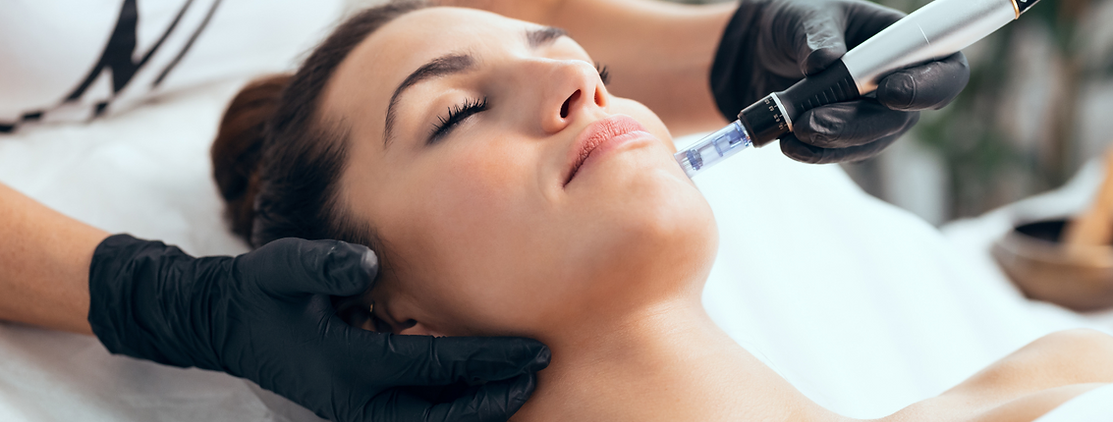 Microneedling-1.png