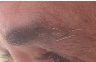 Picturebrow.png