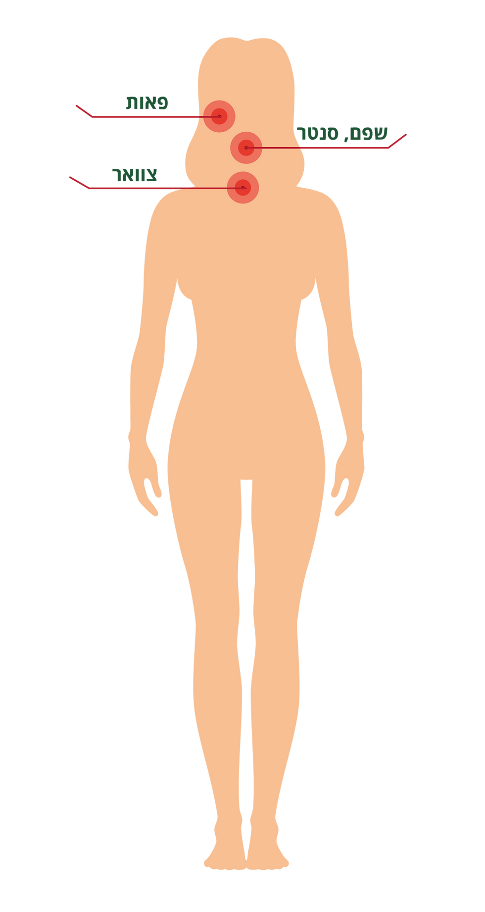 הדמיה של הסרת שיער בפנים לאישה להמחשת האזורים בלבד