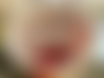 Fruit flies: The head lice of summer