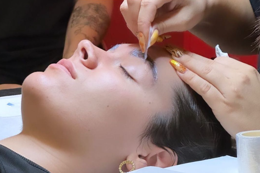 brow lift