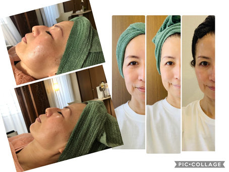 1ヶ月半での変化