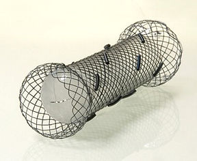 esophageal stent.jpg
