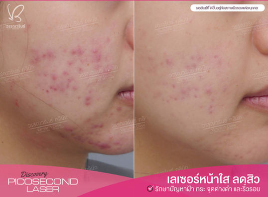 _6BEFORE & AFTER.jpg