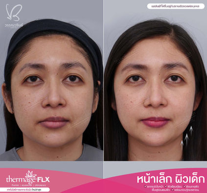 _4BEFORE & AFTER.jpg
