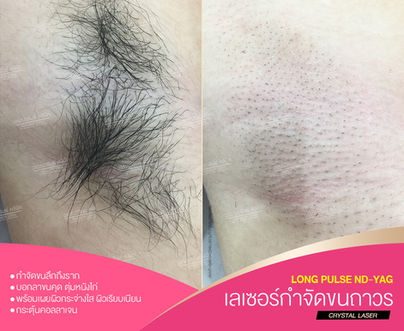 _12BEFORE & AFTER.jpg