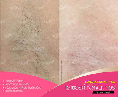 _4BEFORE & AFTER.jpg