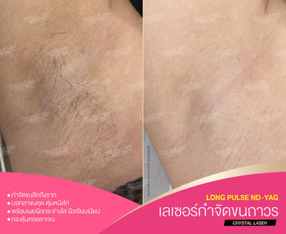 _5BEFORE & AFTER.jpg