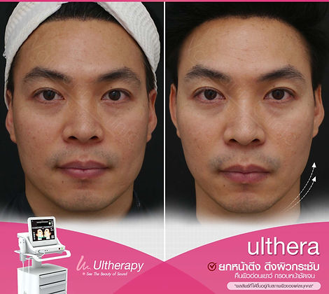 _5BEFORE & AFTER.jpg