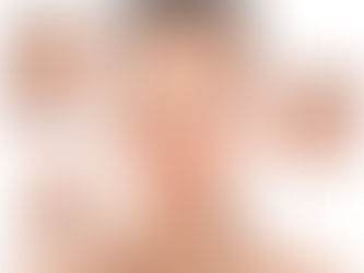 Rosácea: cuidados en tu rutina y maquillaje