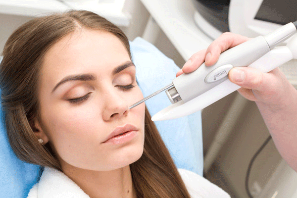 Light Laser Peel Procedure