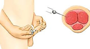 Que fármacos se usan para el tratamiento de la Impotencia Sexual