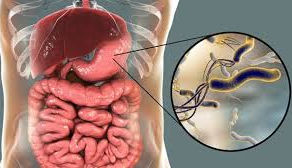 ¿POR QUE SE ORIGINA LA GASTRITIS?