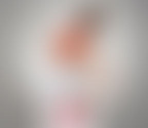 ¿Por que Duele Mucho La Espalda