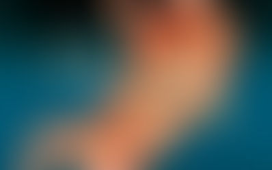 Como combatir el Helicobacter Pylori en casa