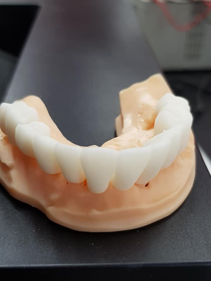 Thumbnail: Senertek TEMP (Temporary) Resin (0.5L)