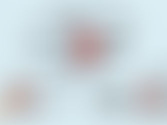 The Invisible Enemy: Understanding Suction Force in Resin 3D Printing