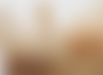 What Makes High-Quality Dental Resin Different from Standard Resin?