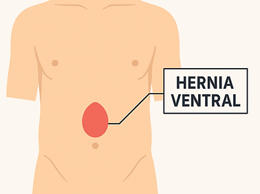 ventral.png