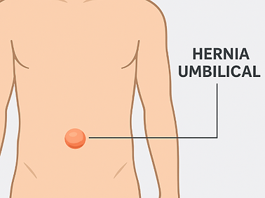 umbilical.png