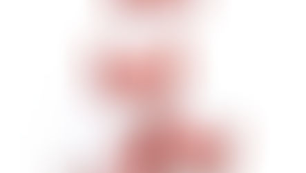 Canada Joins The Party