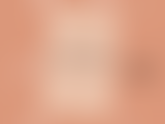 La dysplasie chez le chien