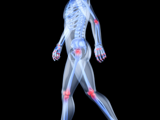 Chiropractic for Arthritis