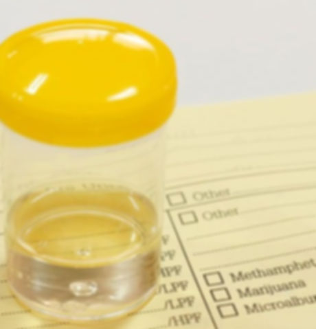 Clean Catch Urine Sample and Culture_edited.jpg