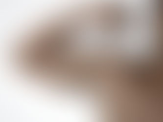 【ポパイサインって知ってますか?】上腕二頭筋長頭の断裂