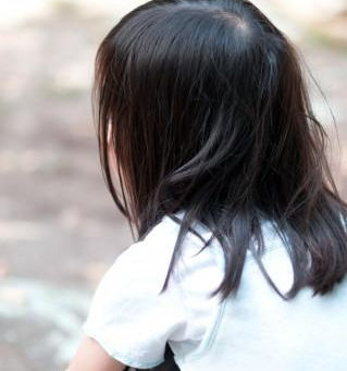 【急に首が痛くて傾いちゃいました。環軸椎回旋位固定