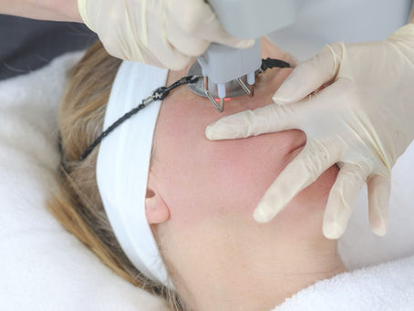 Co2 Laser Treatment At Laser & Skin Belfast