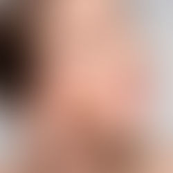 Mulher passando protetor solar no rosto