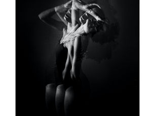 Exploring the Potential of Acupuncture in Supporting Polycystic Ovary Syndrome (PCOS): A Holistic Approach