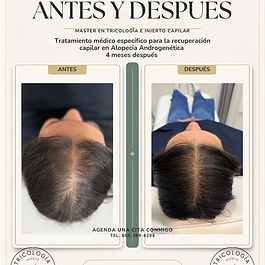 Publicación de antes y después de tricología.jpg
