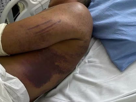 Militares são denunciados por tentar matar major da PM torturado e dizer para família que ele estava internado por Covid, diz MP