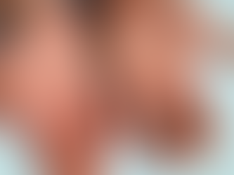 Goiás investiga cinco casos suspeitos de Mpox em 2026