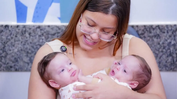 ‘Alta complexidade’: siamesas passarão por nova cirurgia para preparar separação em Goiânia