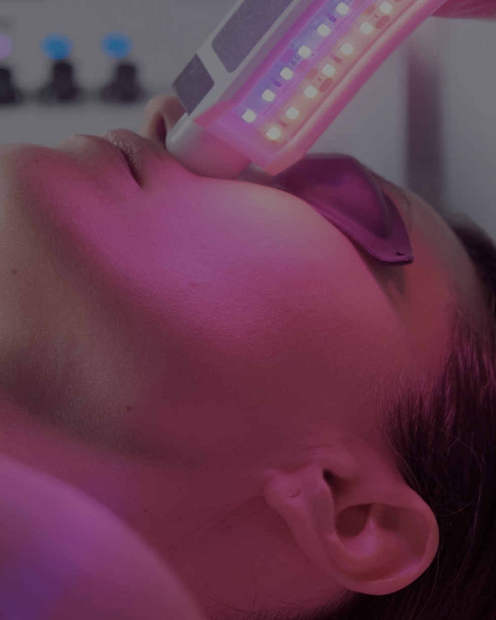 women receiving microdermabrasion in reading, Berkshire near Hampshire
