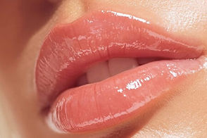 Skin-Fill-Bacio-lèvres.jpg