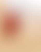 Wisdom Teeth: Your Recovery