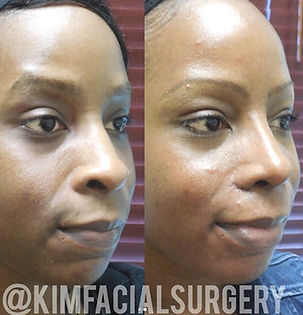 kimfacialrhino20190408.jpg
