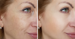 Aging Triads and Treatments