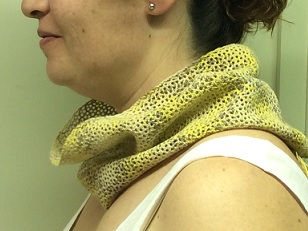 Miniatura: Gorgera trencadís