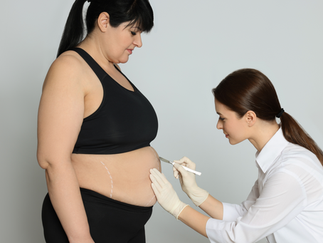 Tail Coverage and Prior Acts: Bariatric Specialists' Guide to Extended Protection