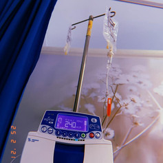 1st infusion of new treatment plan of Ustekinumab