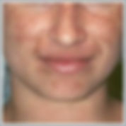 4a before.jpeg