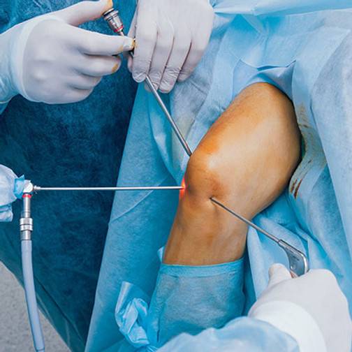 Arthroscopy.jpg
