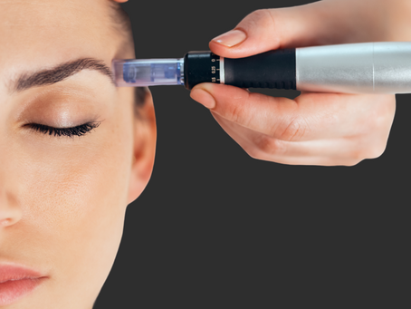 Microneedling + Medical Skincare: The Ultimate Duo for Next-Level Results